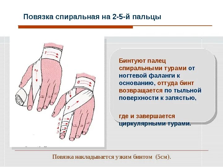 Бинтование при переломе пальцев. Наложение повязки на палец. Спиральная повязка на палец. Наложение бинтовой повязки на палец.