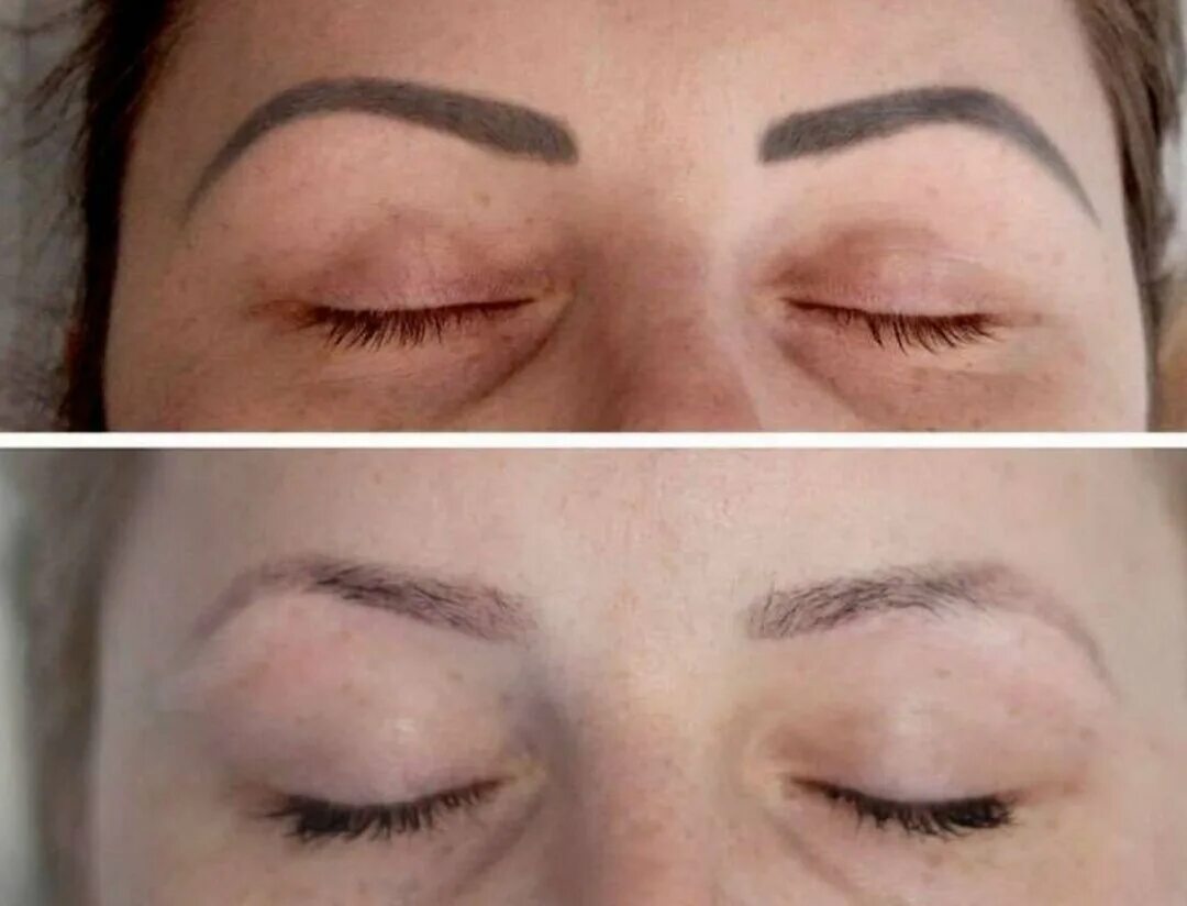 Dear ladies, I invite you to the procedure of removing the remover of an old und