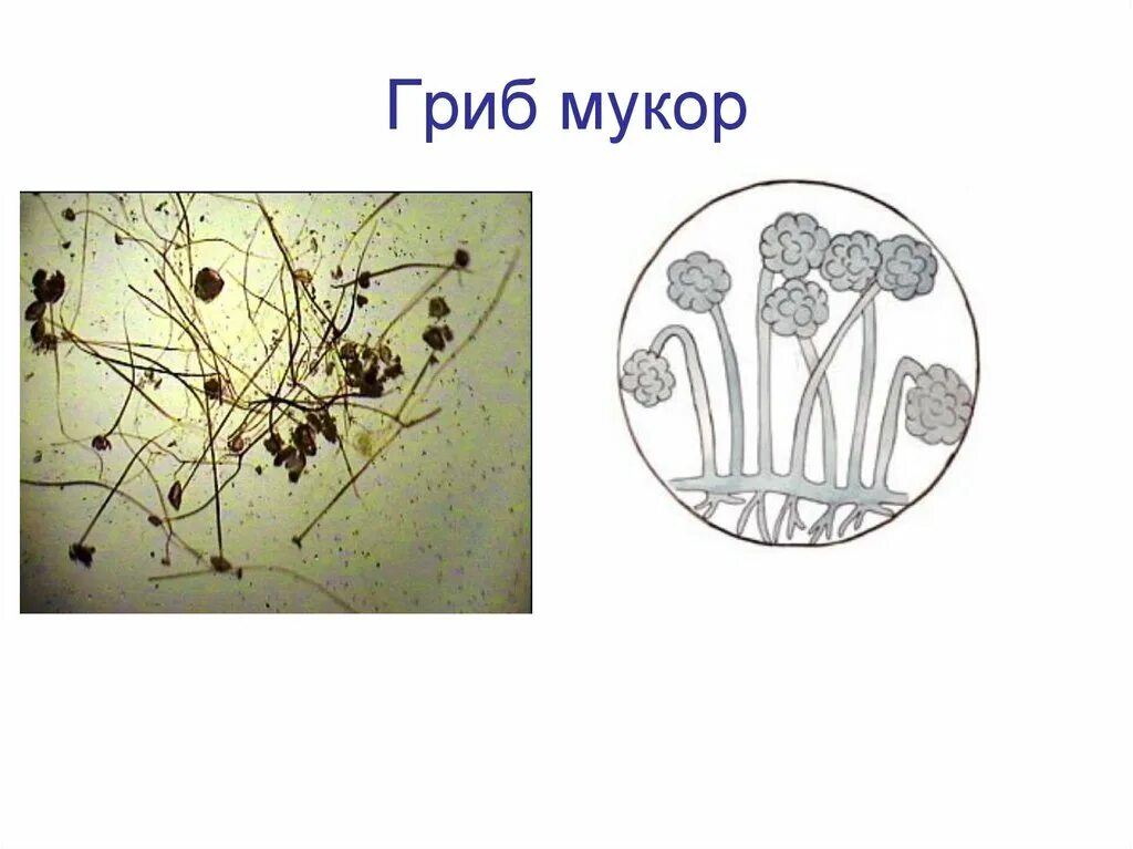 Строение плесневого мукора. Плесневые грибы Mucor. Строение мицелия мукора. Плесень мукор под микроскопом. Строение грибов рода Mucor.