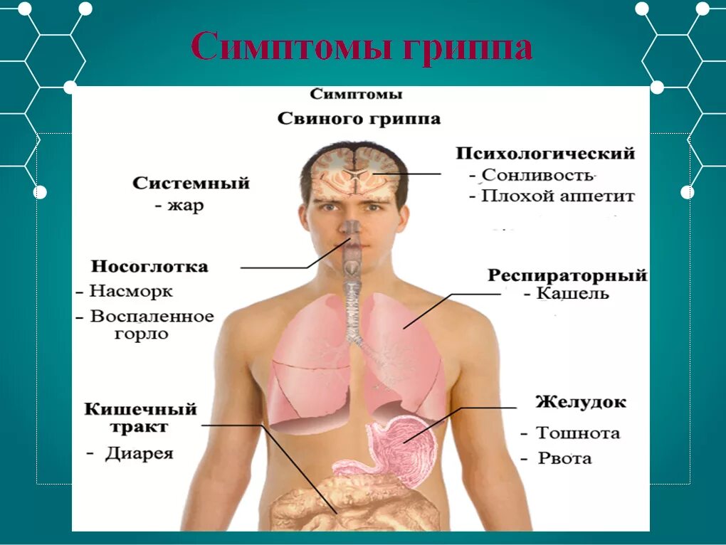 Грипп какое лечение. Симптомы гриппа. Признаки гриппа. Основные симптомы гриппа. Типичные симптомы гриппа.