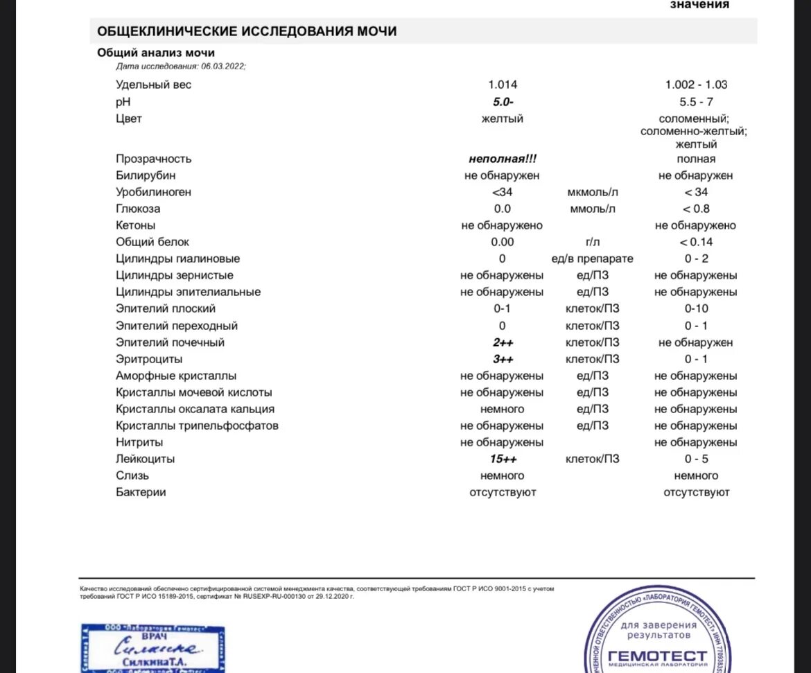 Анализ мочи. Общий анализ мочи. Плохой анализ мочи. Интерпретация анализа мочи. Слизь в моче плюс