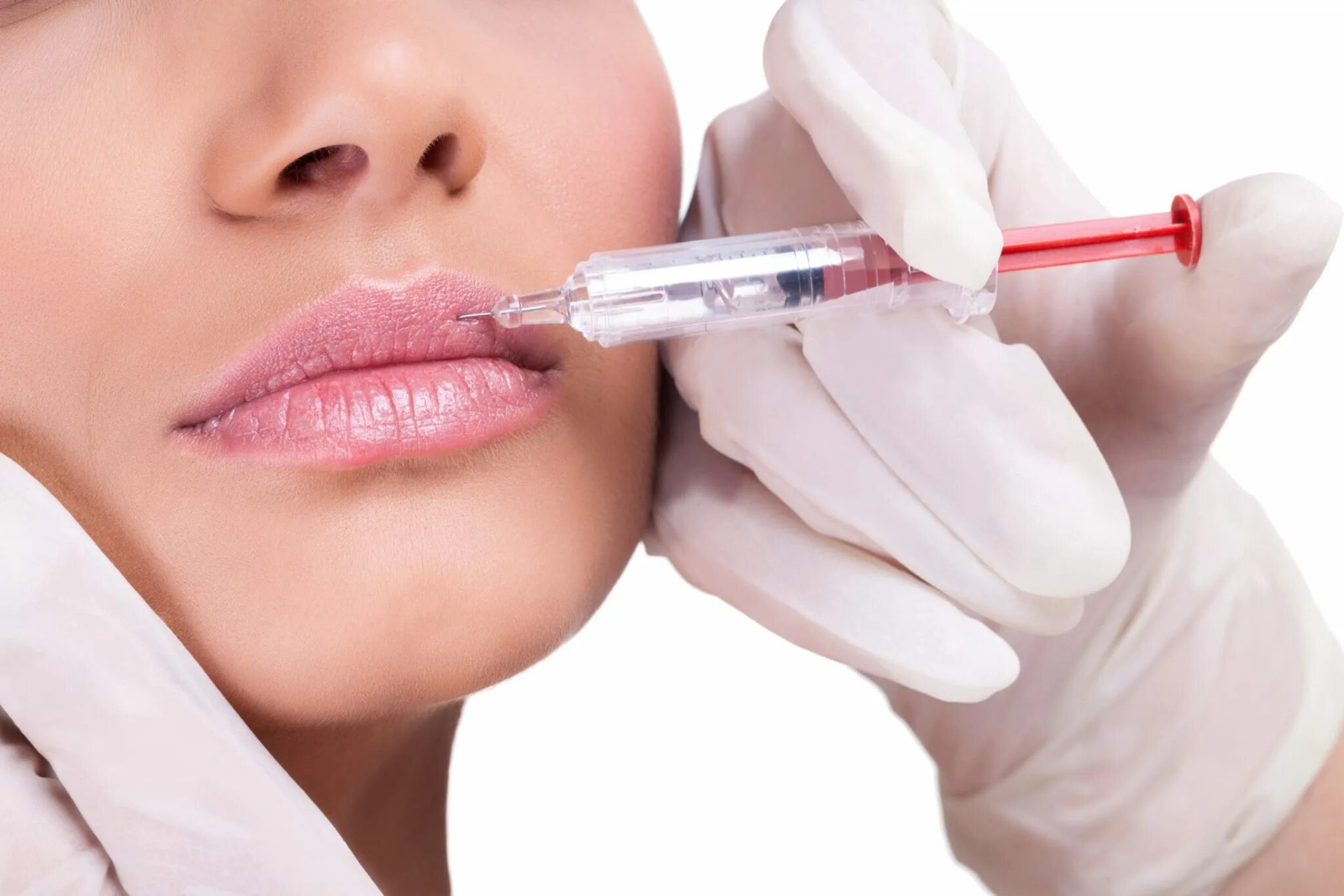 Что такое аугментация губ. Инъекции гиалуроновой кислоты. Губы косметология.
