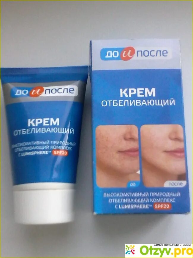 Лучшие средства от пигментных. Крем для лица до и после от пигментных пятен. от темных пятен на лице мазь. мазь от пигментации на лице. крема мази от пигментации.