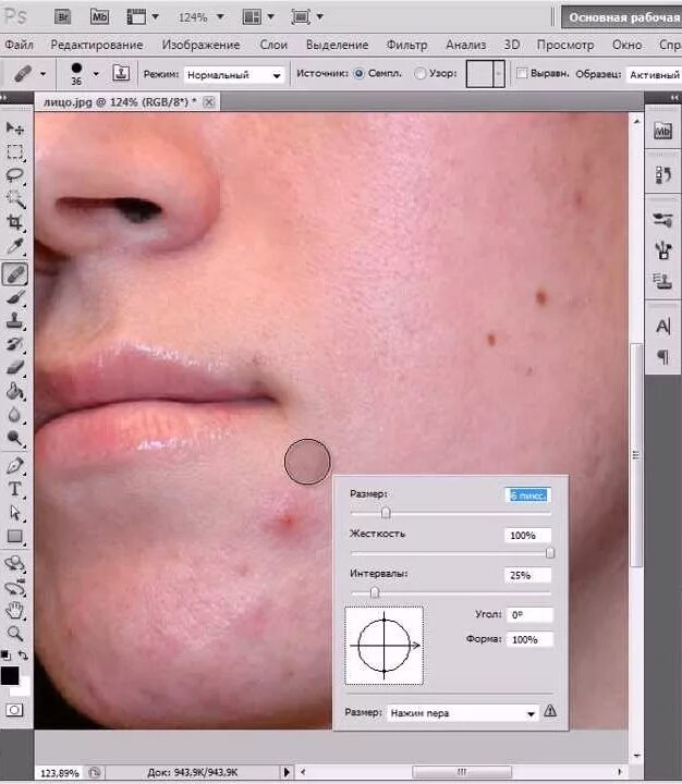 Убирание прыщей в фотошопе. Редактор фотографий от прыщей.