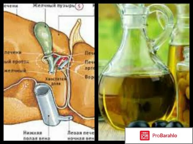 масло с лимоном для очистки печени. чистка печени по морису. масло с лимоном для очистки печени. тюбаж лимонный сок и оливковое масло. почистить печень маслом.