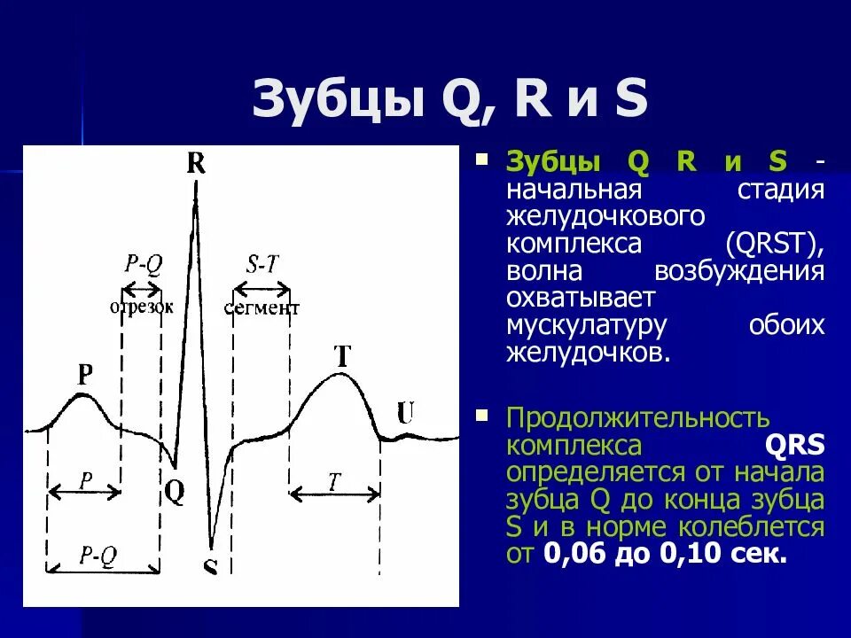 Основа q s. Зубец QRST на ЭКГ. Интервал QRST на ЭКГ норма. Зубцы QRST на ЭКГ отражают. Зубцы ЭКГ R зубец.