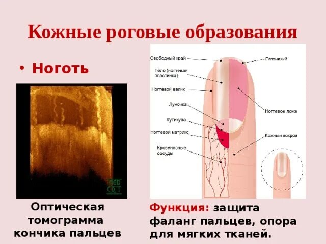 Кожные роговые образования это