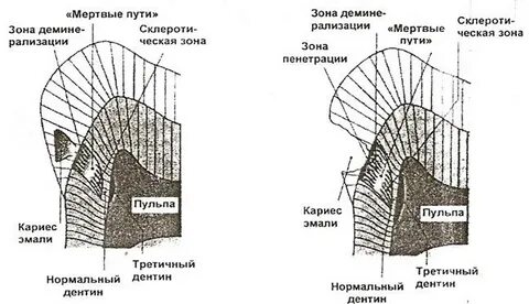 Мертвые пути