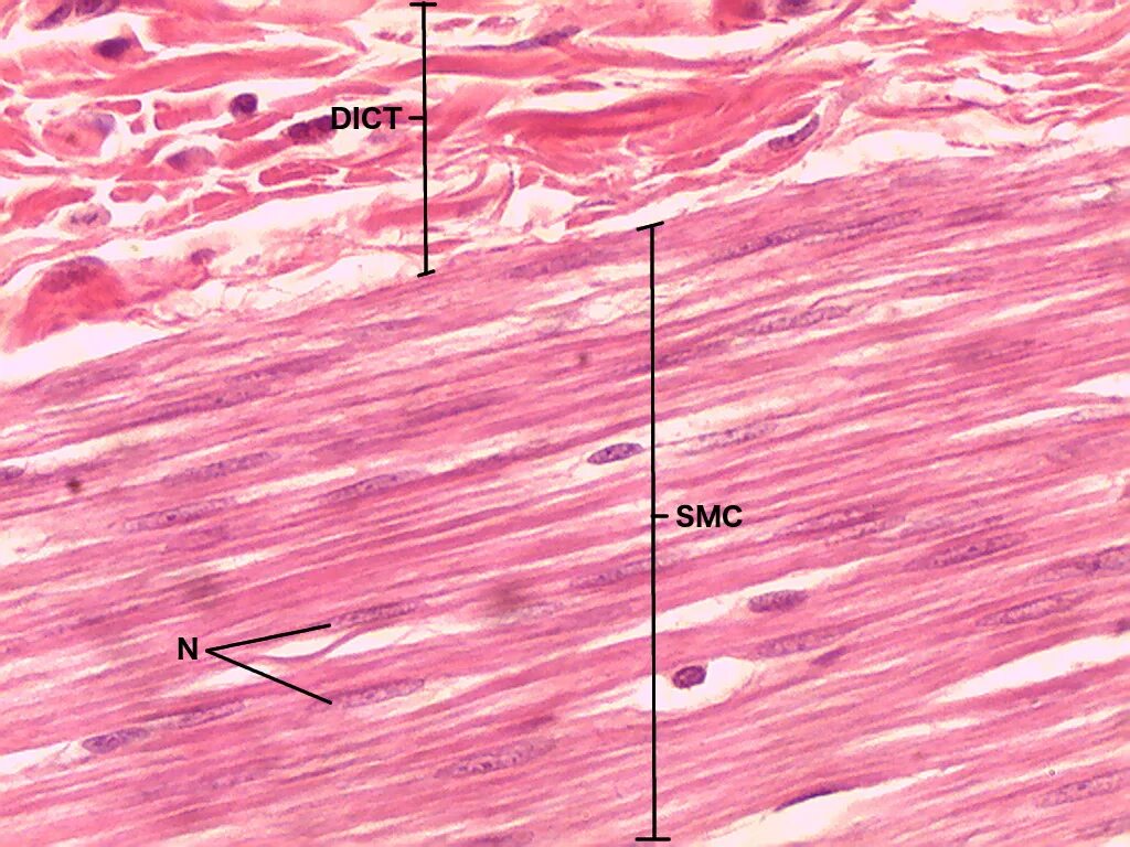 Гладкие мышцы многоядерные. Smooth muscle Histology. Smooth muscle Tissue Histology. Гладкие мышцы под микроскопом. Реснитчатые гладкие мышцы.