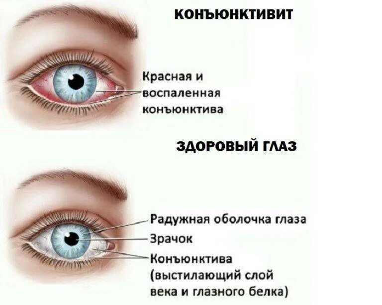Почему болит под глазом