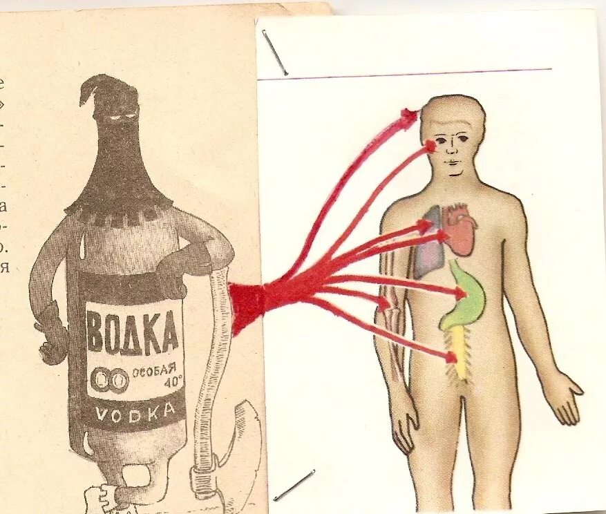 Виски орган человека