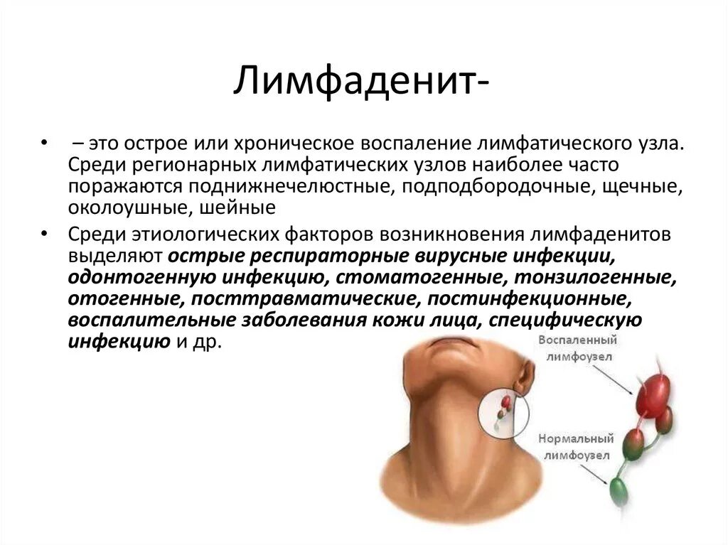 Почему появляются воспаления. Околоушные лимфатические узлы воспаление. Острый неспецифический лимфаденит клиника. Воспаление лимфатических узлов симптомы. Поверхностные шейные лимфоузлы воспаление.