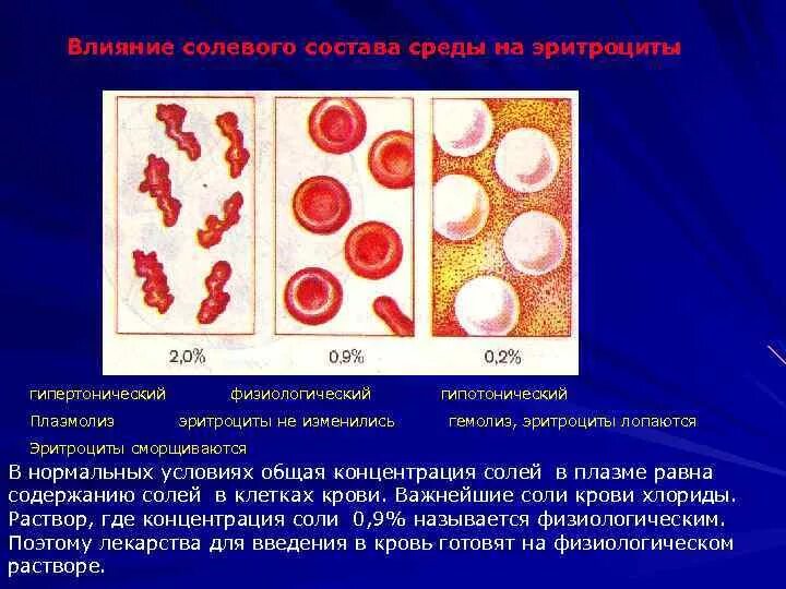 Эритроциты в растворе хлорида натрия. Гипертонический раствор эритроциты. Влияние состава среды на эритроциты. Эритроциты в Соляном растворе.