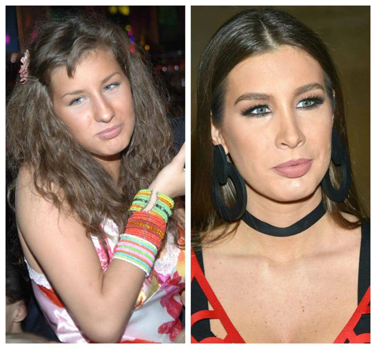 Кэти топурия до пластики. Кэти топурия до пластики. Топурия до и после пластики. Топурия до и после пластики. Топурия кэти с носом.