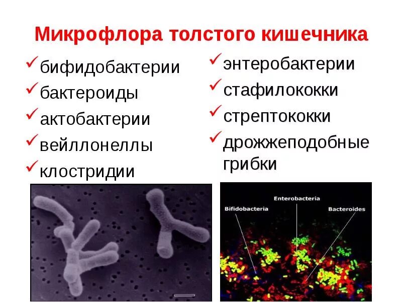 Бифидобактерии где. Представители транзиторной микрофлоры Толстого кишечника. Функции микрофлоры тонкого кишечника. Бактерии нормальной микрофлоры Толстого кишечника. Бактерии представители нормальной микрофлоры кишечника.