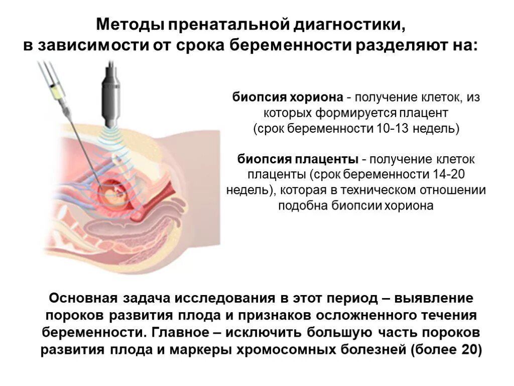 Методы пренатальной диагностики УЗИ амниоцентез биопсия хориона. Биопсия хориона амниоцентез кордоцентез. Метод биопсии хориона применяется на сроке беременности:. Методы перинатальной диагностики биопсия хориона. Осложнения после биопсии