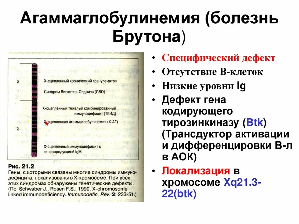 Иммунодефицит брутона. Агаммаглобулинемии Брутона). Агаммаглобулинемия болезнь Брутона. Болезнь Брутона патогенез. Болезнь Брутона клинические проявления.