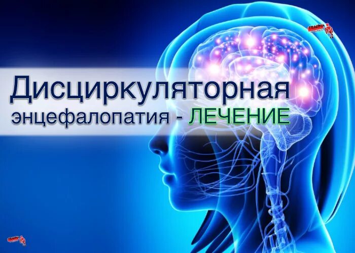 Дисциркуляторная энцефалопатия головного мозга. Дисциркуляторной энцефалопатии. Лекарства от энцефалопатии головного мозга у взрослых. Дисциркуляторная энцефалопатия лечение.