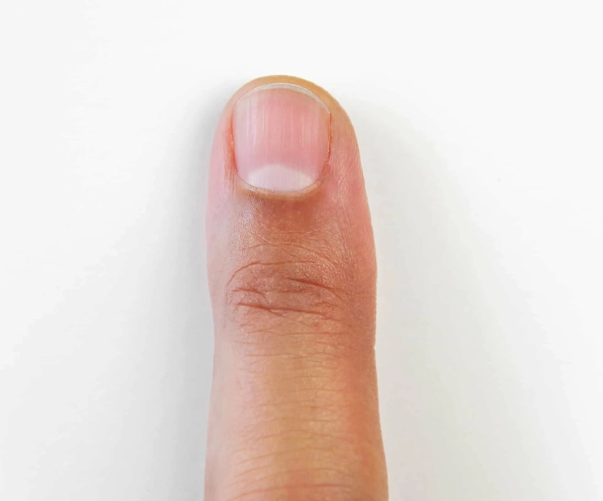 Ногти на больших пальцев мужчин. Вмятина на ногте большого пальца.