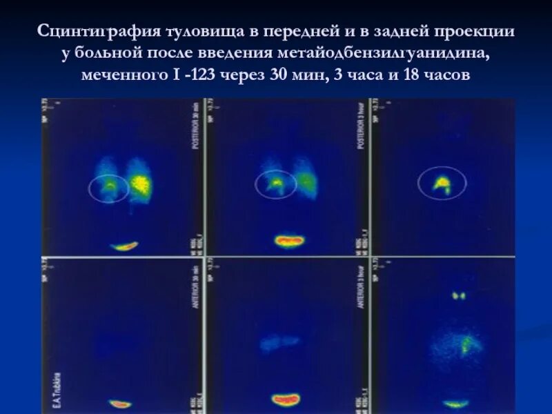 Легочная гипертензия Інтернет-видання "Новини медицини та фармації"