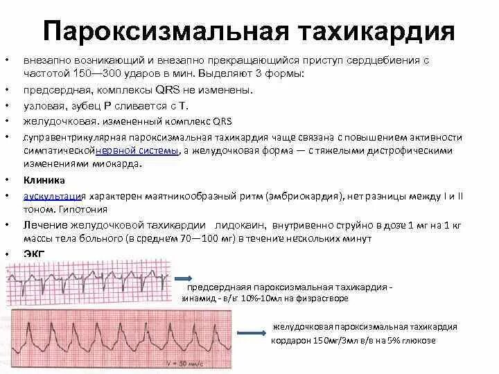 Наджелудочковые пароксизмальные тахикардии экг. Наджелудочковые пароксизмальные тахикардии экг. Ответы на тесты наджелудочковые тахикардии по утвержденным. Ответы на тесты наджелудочковые тахикардии по утвержденным. Наджелудочковые пароксизмальные тахикардии экг.