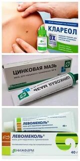 Лучшее от папиллом