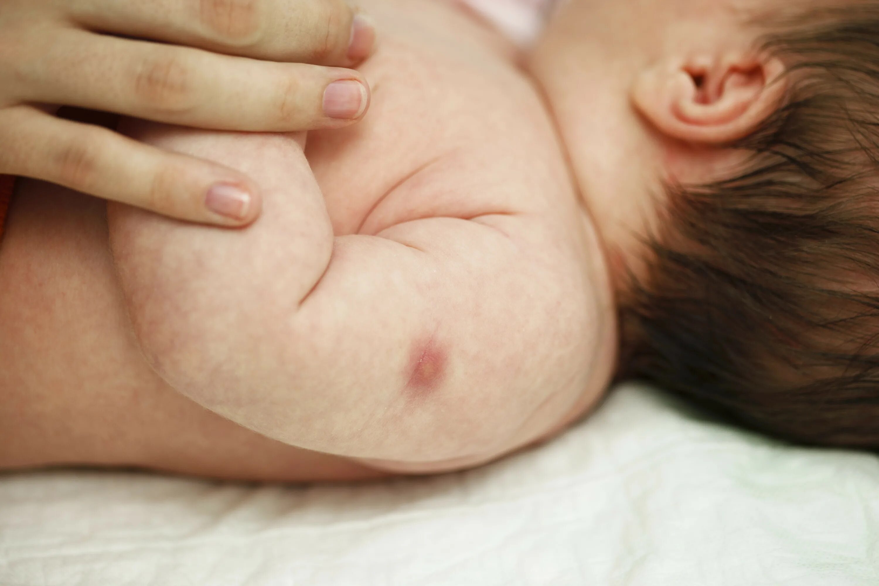 Бцж вакцина реакция. Прививка БЦЖ-М новорожденному. Папула БЦЖ У новорожденных. БЦЖ прививка для новорожденных.