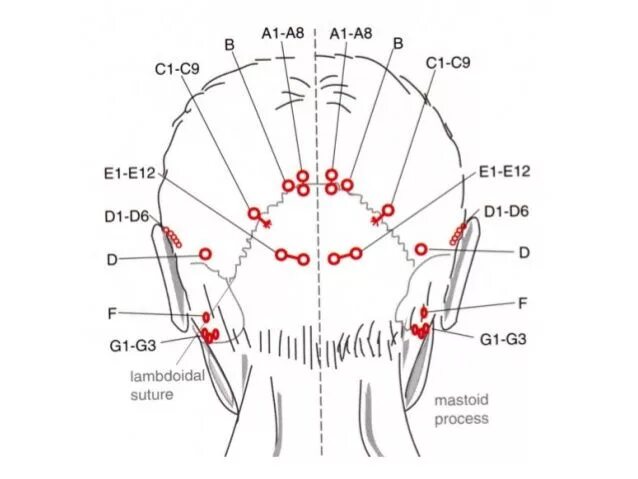 Точки на затылке. Акупунктурные точки головы схема. Акупунктурные точки на голове человека схема расположения. Иглоукалывание головы схемы.