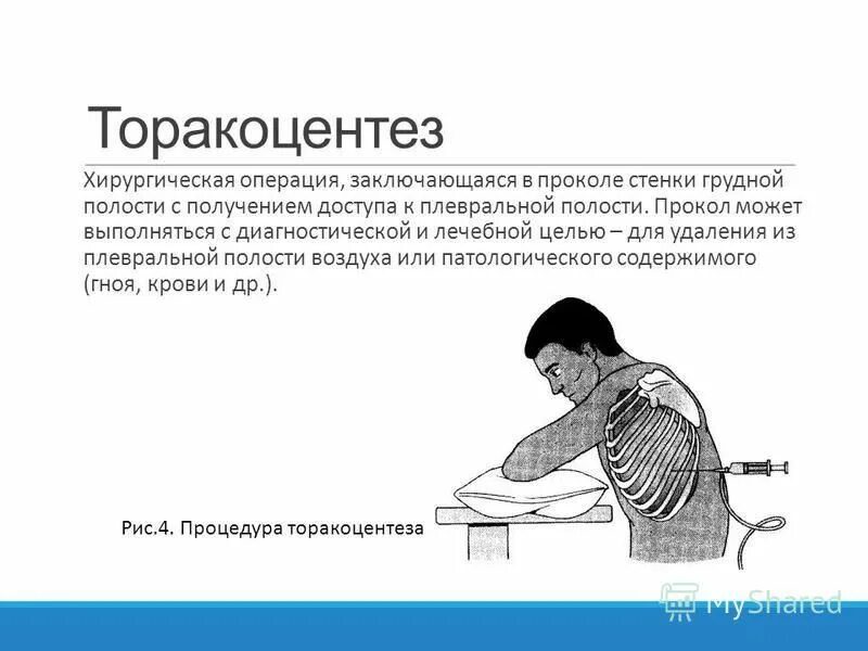 Операции заключается в том что