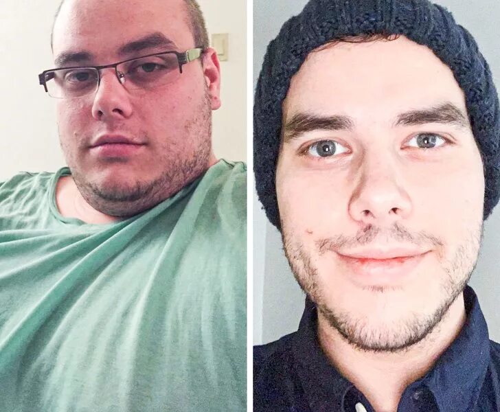 Лицо после похудения. Лицо до и после похудения. Лицо до и после похудения мужчины. Люди изменившие внешность. Резко изменилось лицо