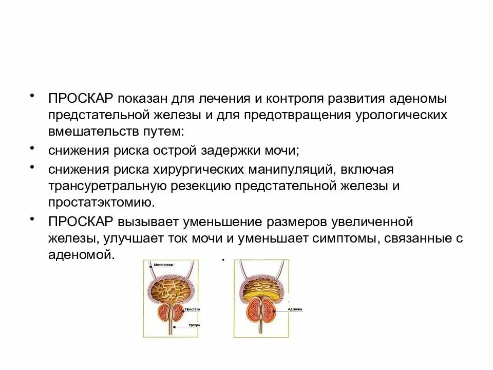 Аденома простаты возраста. Аденома предстательной железы острая задержка мочи. Острая задержка мочи при аденоме предстательной железы. Доброкачественная гиперплазия предстательной железы. Острая задержка мочеиспускания при ДГПЖ.