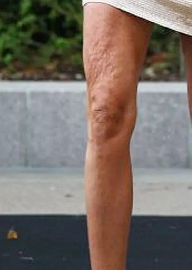 Торчащие коленки. Торчащие коленки. Девушка с уоивыми ношами. Женские колены. Тонкие ноги.