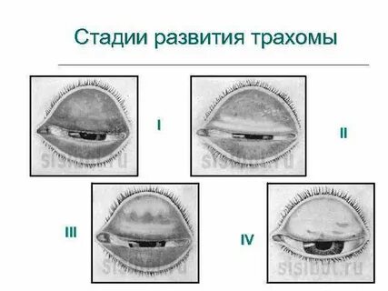 На первых стадиях ее