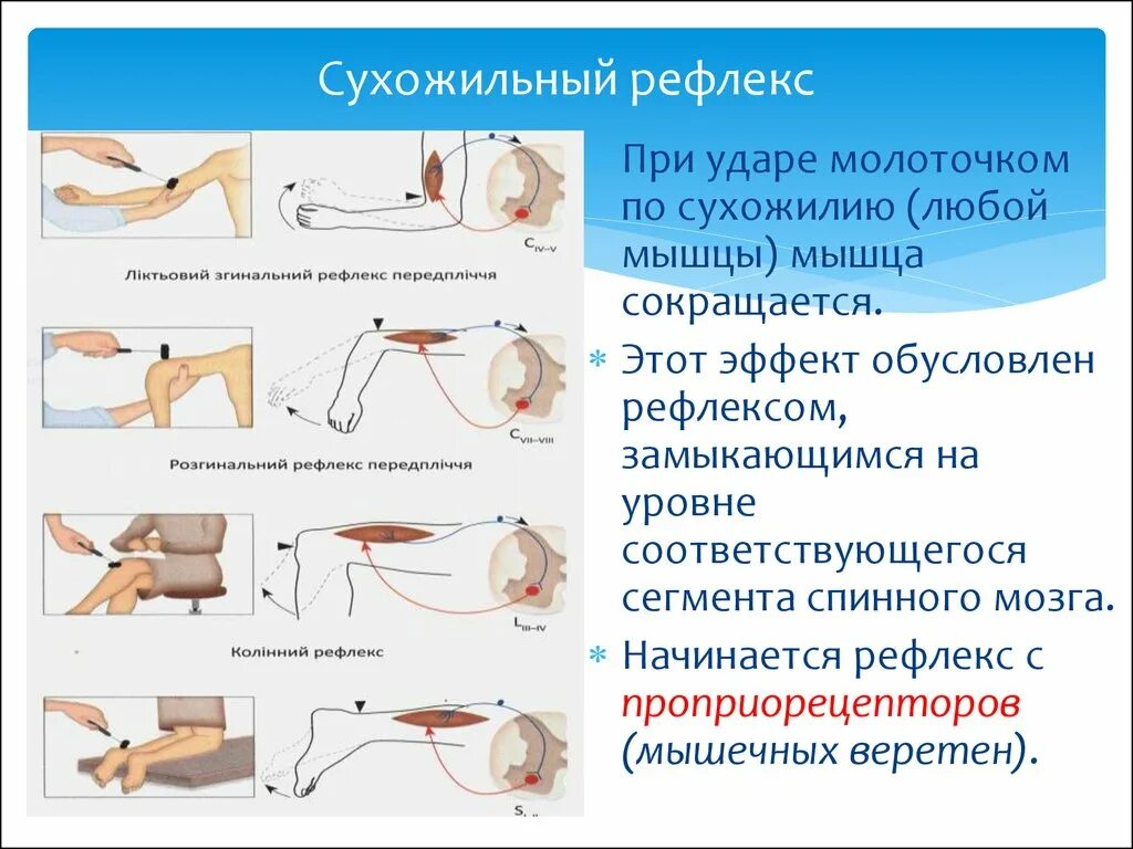 Сухожильные рефлексы рефлексов. Оценка сухожильных рефлексов неврология. Сухожильные рефлексы нижних конечностей неврология. Исследование сухожильных рефлексов на верхних конечностях. Проверка рефлексов