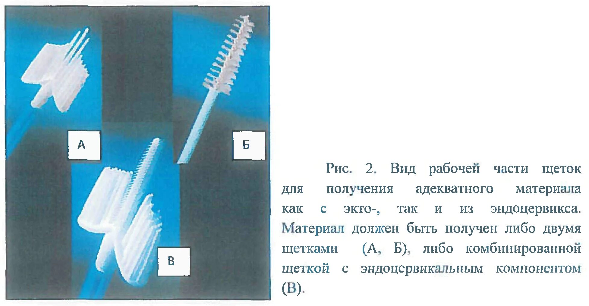 Что такое жидкостная цитология шейки матки. Инструмент для взятия цитологических мазков -. Взятие мазков с шейки матки для цитологического исследования. Взятие мазка на цитологию алгоритм. Инструменты для жидкостной цитологии шейки матки.