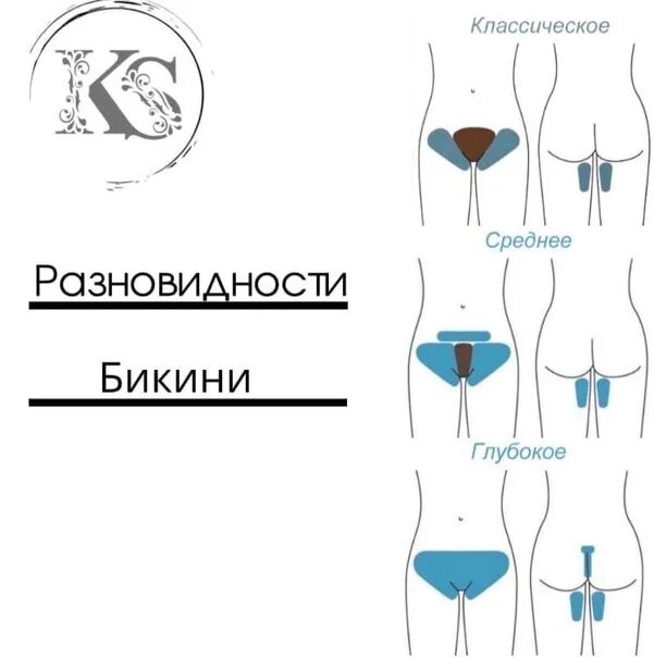 Зоны тела для лазерной эпиляции. Депиляция воском схема нанесения. Схема зон эпиляции. Виды эпиляции зоны. Зоны депиляции в схемах.