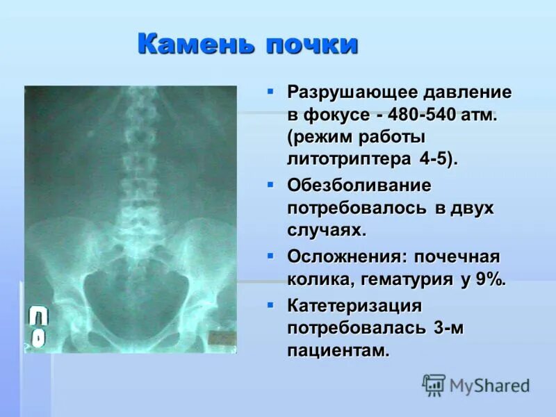 Показатели при артериальном давлении. Испытание на разрушающее давление. Чс военного времени ударная волна. Степень разрушения зданий при избыточном давлении. Степени разрушения зданий.