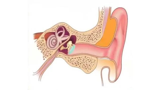 Заложенность уха тубоотит. Острый катаральный буллезный отит. Буллёзный отит барабанная перепонка. Острый буллезный средний отит.