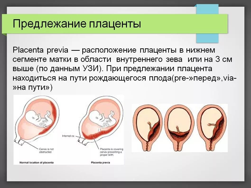 Центральное прикрепление плаценты при беременности в 12 недель. Краевое предлежание плаценты у беременных 12 недель. Нижний край плаценты у внутреннего зева. Полное центральное предлежание плаценты. Шейка в 12 недель