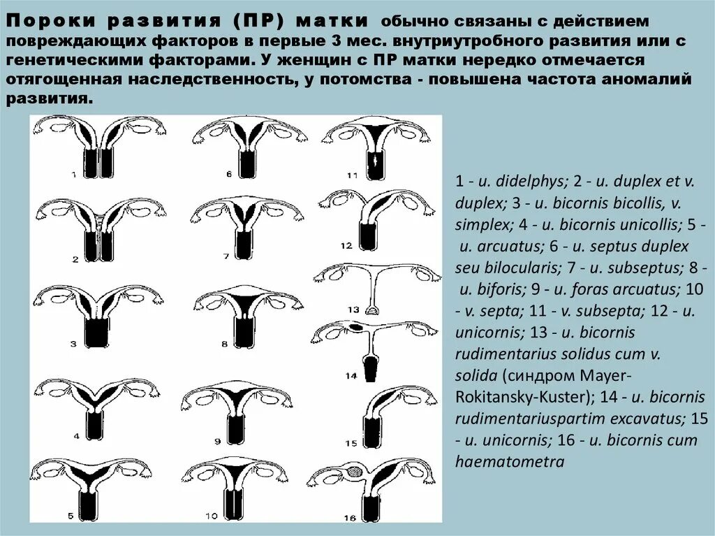 Классификация пороков развития матки по Адамян. Аномалии развития матки классификация. Внутриутробные пороки развития. Врожденные пороки развития матки.