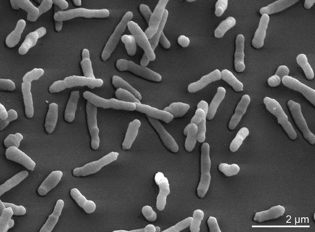 2 бактерии 1 8. Cellulomonas. Cellulomonas effiisa:. Cellulomonas SP.,. Текстура бактерии.