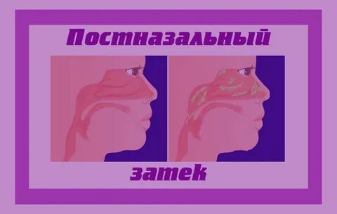 Чем лечить постназальный затек у взрослого препараты