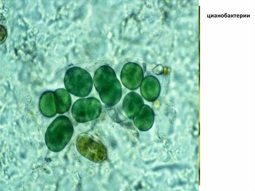 Синезеленые цианобактерии. Цианобактерии сине-зеленые водоросли. Цианобактерии одноклеточные водоросли. Цианобактерия Анабена.
