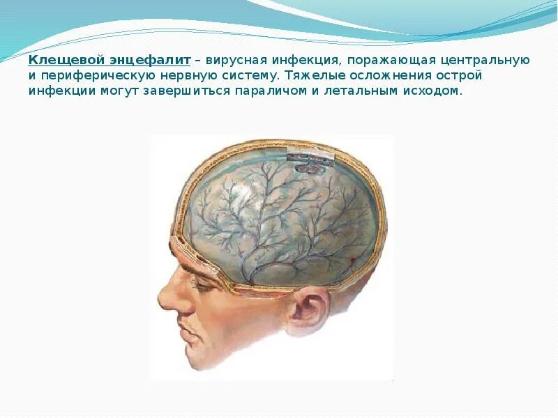 Энцефалит мозга у взрослых. Клещевой энцефалит паралич. Менингеальная форма энцефалита. Энцефалит поражение мозга. Клещевой энцефалит парез.