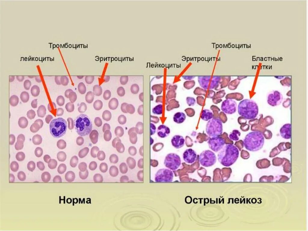 Эритроциты у кошки