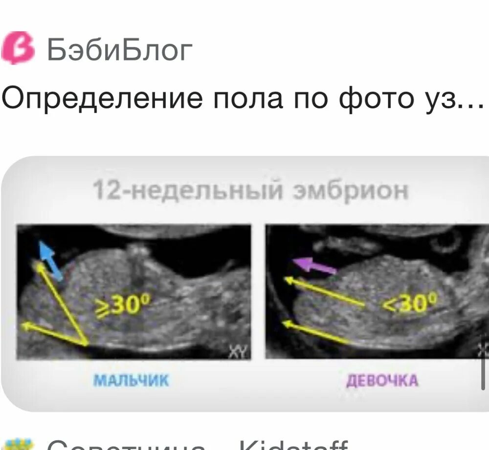 Как по УЗИ определить пол на 12 неделе. УЗИ В 12 недель беременности пол ребенка. Как по УЗИ определяют пол ребенка в 12 недель. Как на УЗИ определяют пол в 12 недель. В каком сроке можно узнать пол ребенка