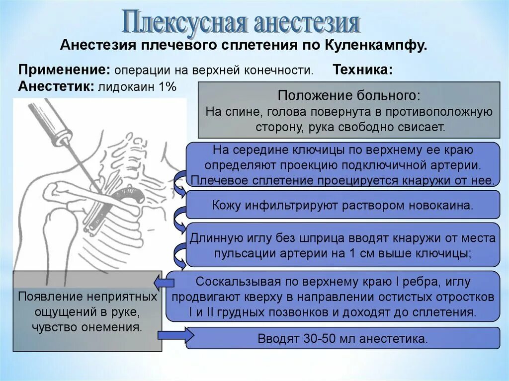 Парестезия анестезии. Блокада по Куленкампфу техника. Плексусная анестезия техника. Проводниковая анестезия по Куленкампфу. Проводниковая анестезия по Куленкампфу показания техника.