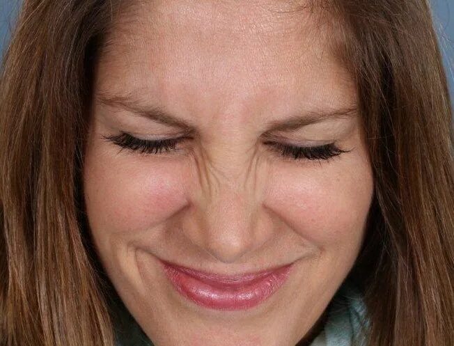 морщить носик. морщить носик. грудничок морщится. морщины межбровья. ребенок морщит нос.