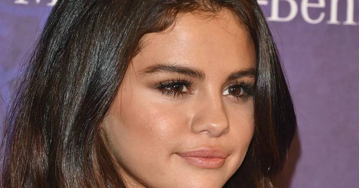 Selena Gomez волчанка. Волчанка у селены гомес