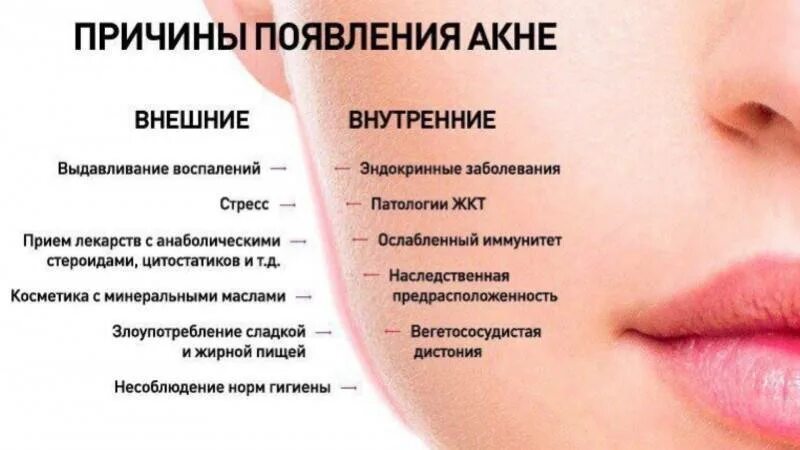 На подбородке прыщи что значит у женщин